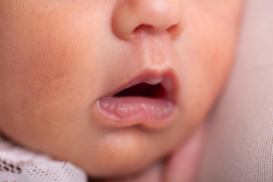 Bibir Bayi Baru Lahir Terlihat Kering dan Pecah-pecah. Normalkah?